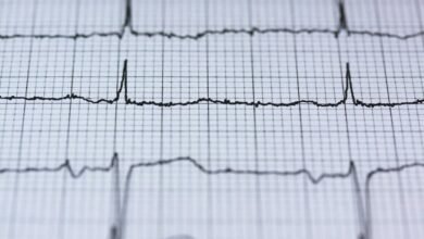 circuit pulse stellar edge